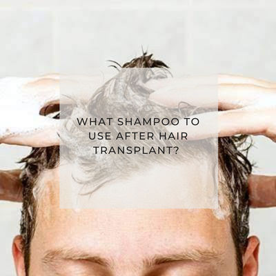 What Are The Best Shampoos After Hair Transplant?  5 Top Picks for Healing