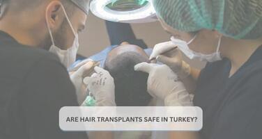 Are Hair Transplants in Turkey Safe? Learn The Deatails