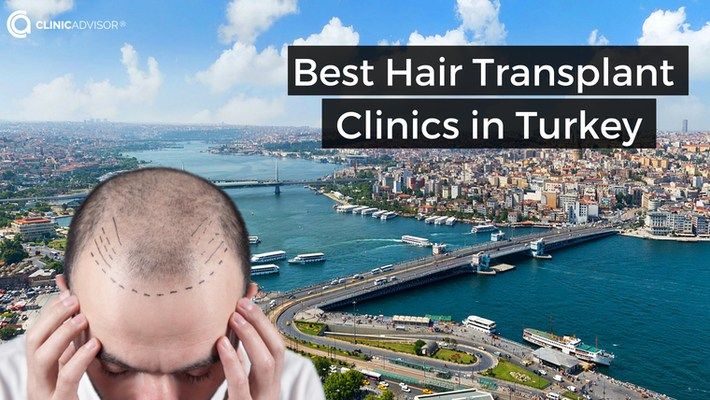 7 Best Hair Transplant Clinics in Turkey for 2025: Price, Results and Recommendations