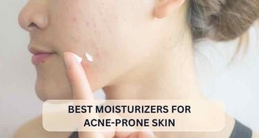 Best Moisturizer for Acne-Prone Skin