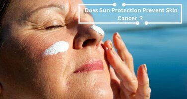 Does Sun Protection Prevent Skin Cancer?