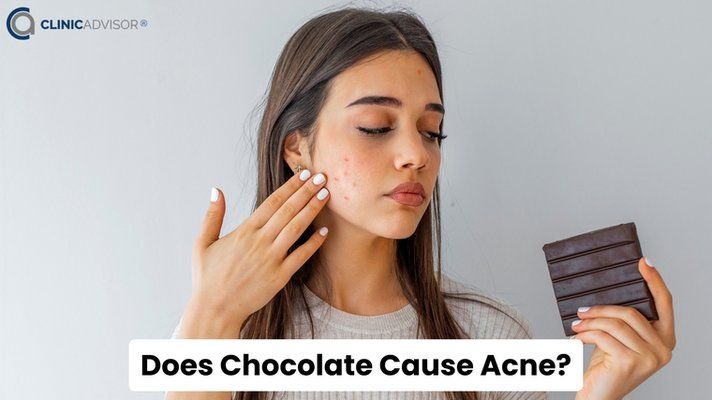 Is Chocolate Bad for Skin and Does It Cause Acne?