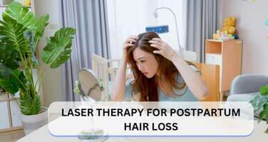 Laser Therapy for Postpartum Hair Loss: Does It Work?