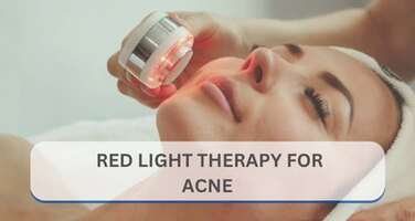 Red Light Therapy for Acne